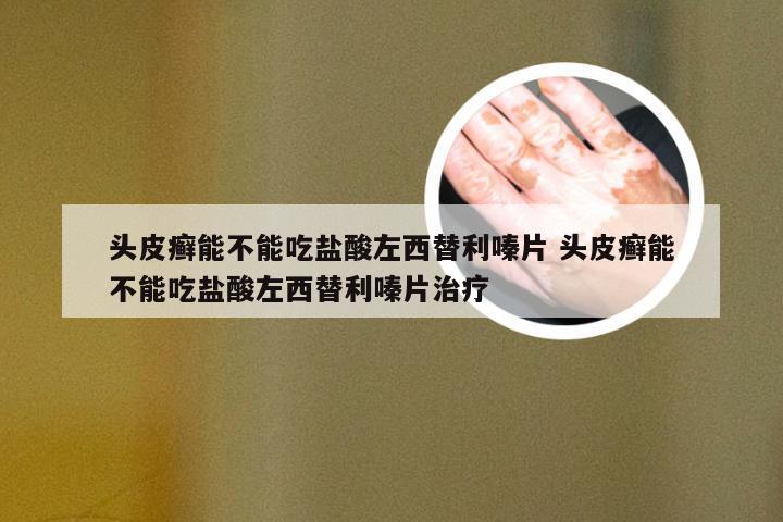 头皮癣能不能吃盐酸左西替利嗪片 头皮癣能不能吃盐酸左西替利嗪片治疗