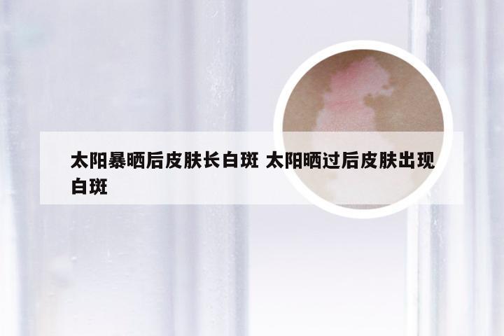 太阳暴晒后皮肤长白斑 太阳晒过后皮肤出现白斑