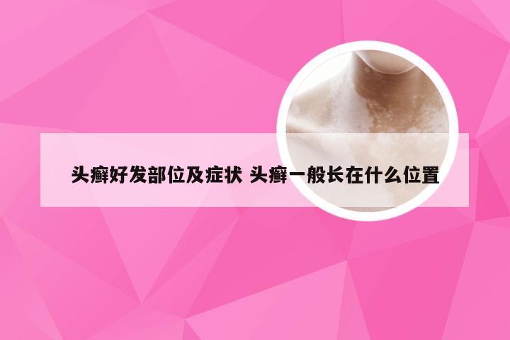 头癣好发部位及症状 头癣一般长在什么位置