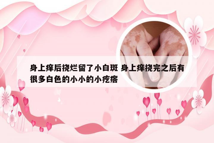 身上痒后挠烂留了小白斑 身上痒挠完之后有很多白色的小小的小疙瘩