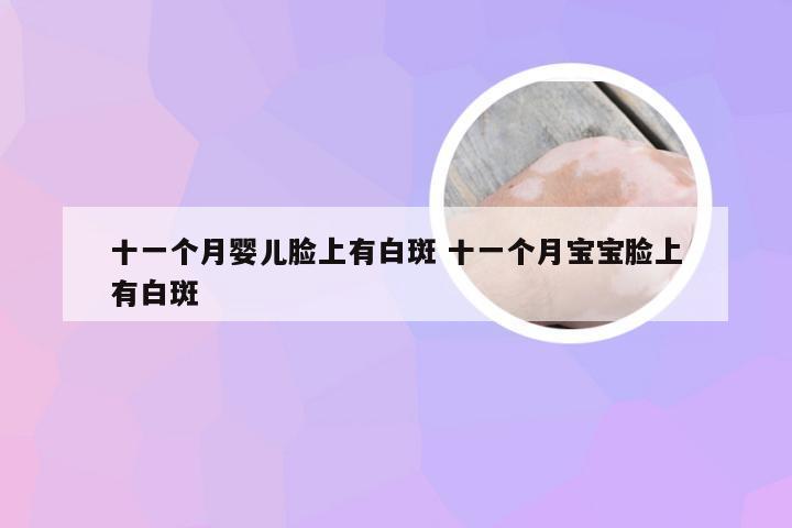 十一个月婴儿脸上有白斑 十一个月宝宝脸上有白斑