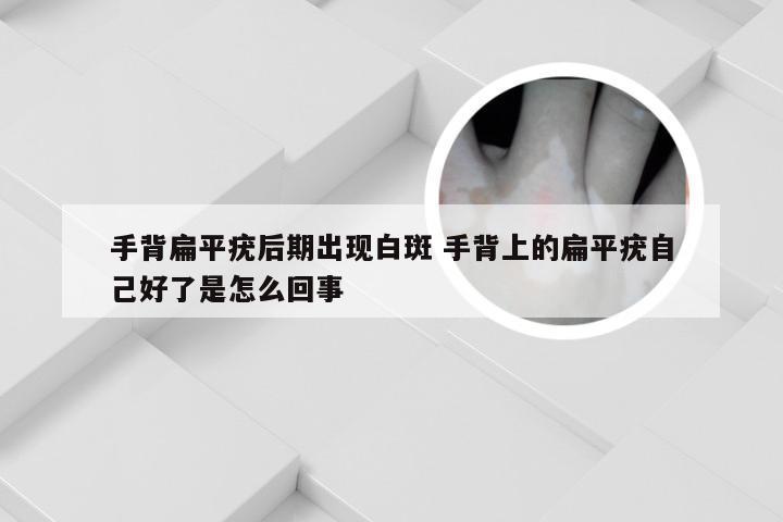手背扁平疣后期出现白斑 手背上的扁平疣自己好了是怎么回事
