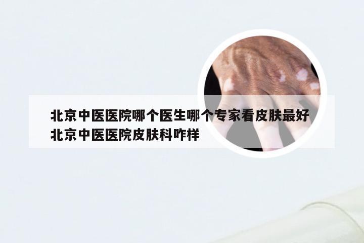 北京中医医院哪个医生哪个专家看皮肤最好 北京中医医院皮肤科咋样