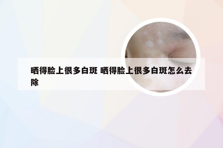 晒得脸上很多白斑 晒得脸上很多白斑怎么去除