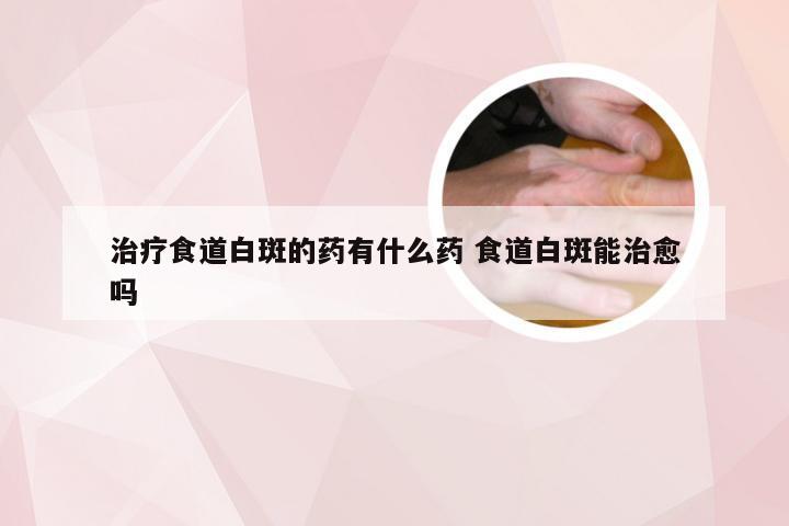 治疗食道白斑的药有什么药 食道白斑能治愈吗