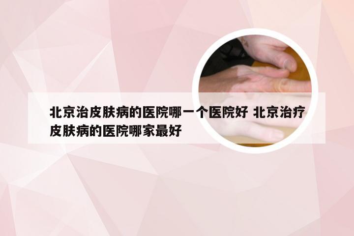 北京治皮肤病的医院哪一个医院好 北京治疗皮肤病的医院哪家最好