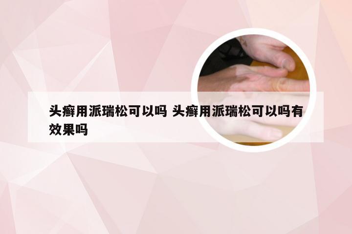 头癣用派瑞松可以吗 头癣用派瑞松可以吗有效果吗