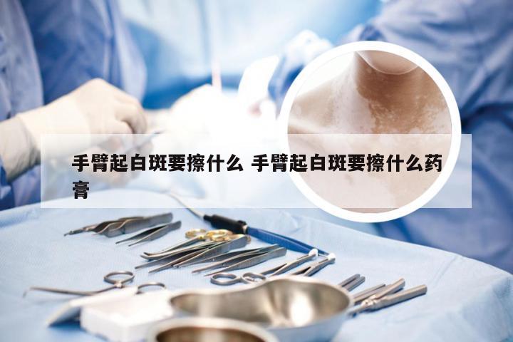 手臂起白斑要擦什么 手臂起白斑要擦什么药膏