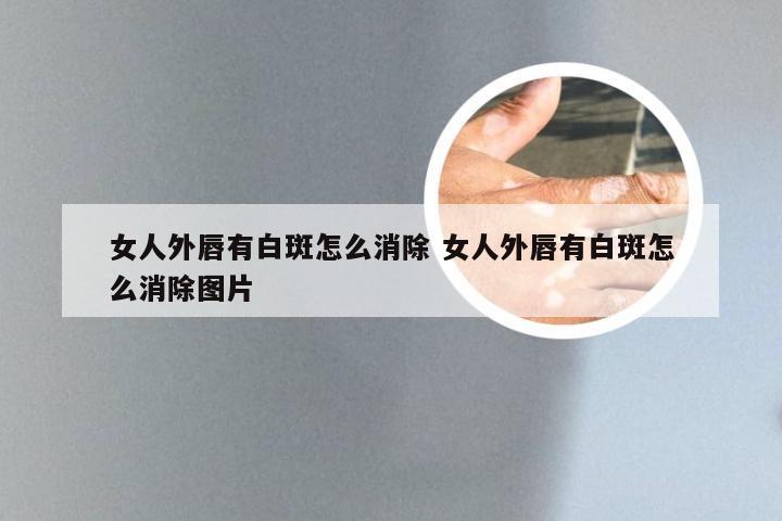 女人外唇有白斑怎么消除 女人外唇有白斑怎么消除图片