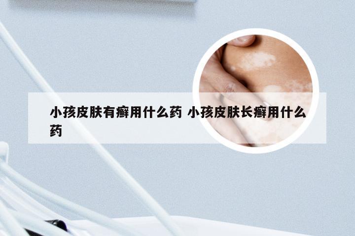 小孩皮肤有癣用什么药 小孩皮肤长癣用什么药