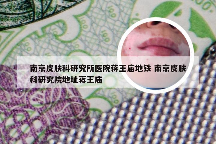 南京皮肤科研究所医院蒋王庙地铁 南京皮肤科研究院地址蒋王庙