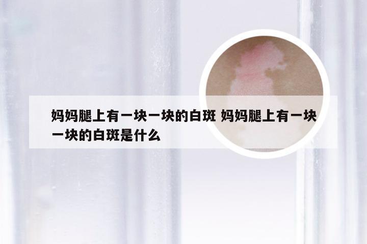 妈妈腿上有一块一块的白斑 妈妈腿上有一块一块的白斑是什么