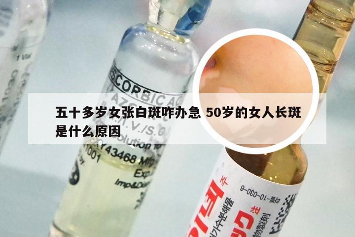 五十多岁女张白斑咋办急 50岁的女人长斑是什么原因