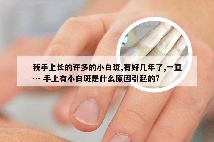 我手上长的许多的小白斑,有好几年了,一直… 手上有小白斑是什么原因引起的?