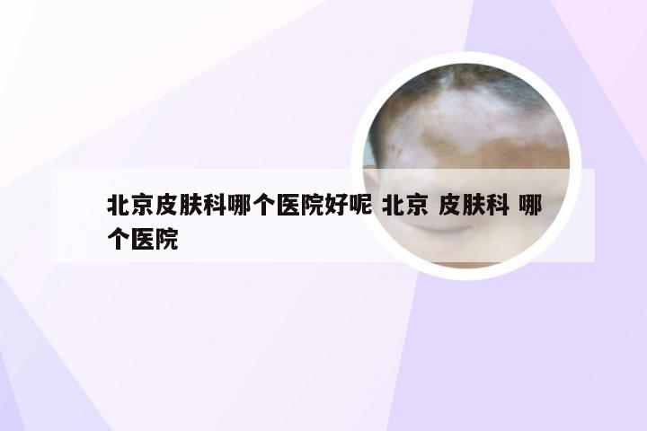 北京皮肤科哪个医院好呢 北京 皮肤科 哪个医院