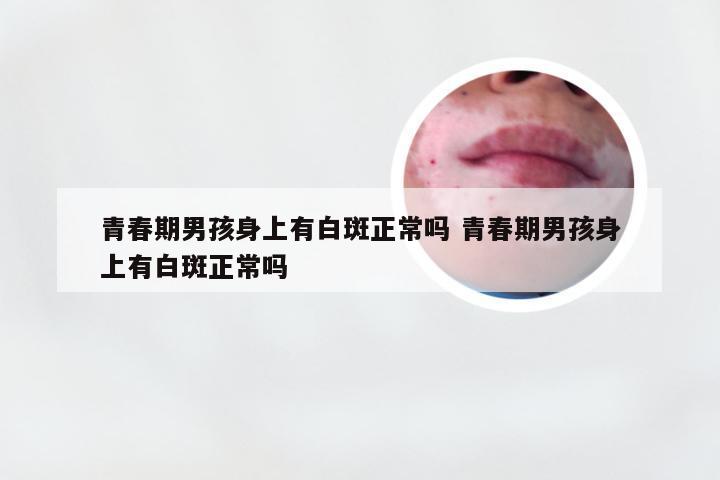 青春期男孩身上有白斑正常吗 青春期男孩身上有白斑正常吗
