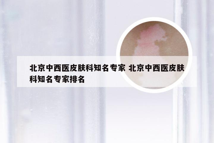 北京中西医皮肤科知名专家 北京中西医皮肤科知名专家排名