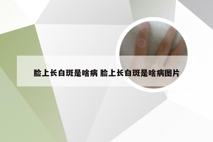 脸上长白斑是啥病 脸上长白斑是啥病图片