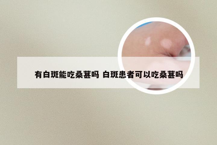 有白斑能吃桑葚吗 白斑患者可以吃桑葚吗