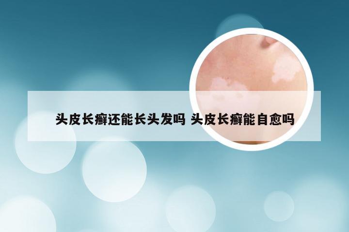 头皮长癣还能长头发吗 头皮长癣能自愈吗
