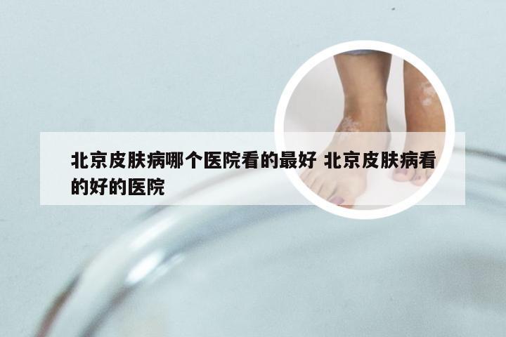 北京皮肤病哪个医院看的最好 北京皮肤病看的好的医院