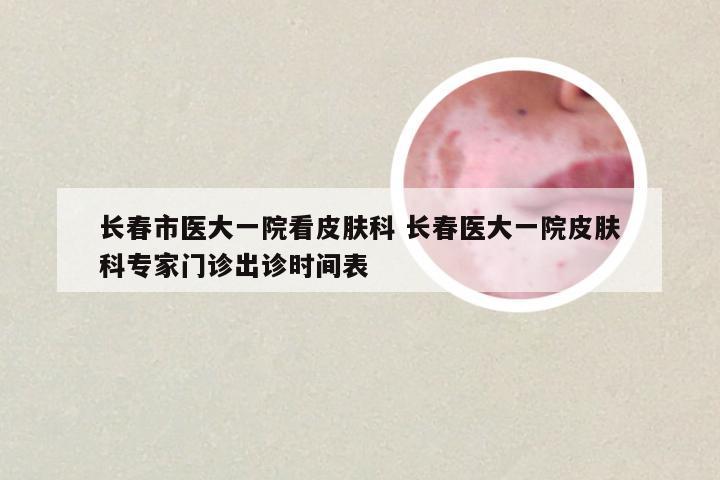 长春市医大一院看皮肤科 长春医大一院皮肤科专家门诊出诊时间表