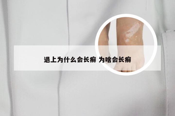 退上为什么会长癣 为啥会长癣