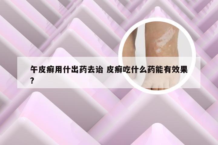 午皮癣用什出药去诒 皮癣吃什么药能有效果?