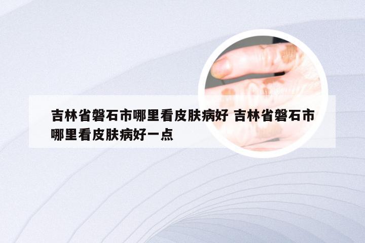 吉林省磐石市哪里看皮肤病好 吉林省磐石市哪里看皮肤病好一点