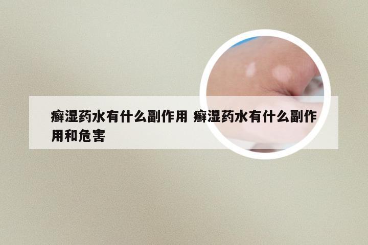 癣湿药水有什么副作用 癣湿药水有什么副作用和危害
