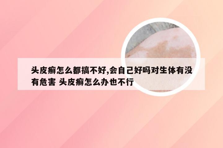 头皮癣怎么都搞不好,会自己好吗对生体有没有危害 头皮癣怎么办也不行