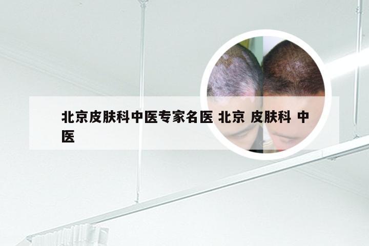 北京皮肤科中医专家名医 北京 皮肤科 中医