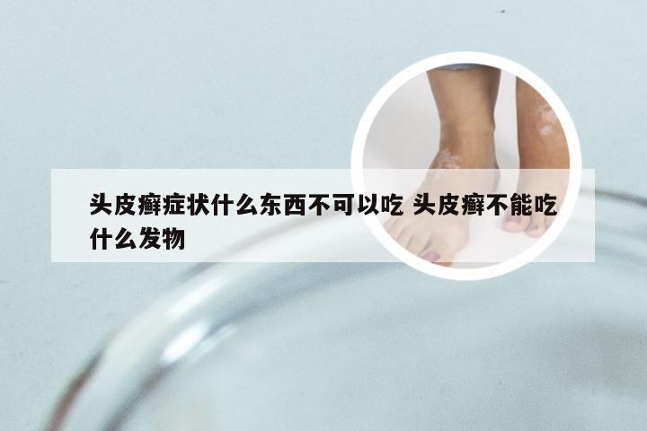 头皮癣症状什么东西不可以吃 头皮癣不能吃什么发物