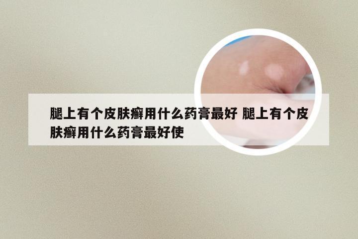 腿上有个皮肤癣用什么药膏最好 腿上有个皮肤癣用什么药膏最好使