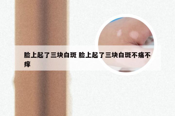 脸上起了三块白斑 脸上起了三块白斑不痛不痒