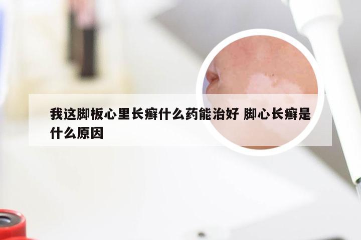 我这脚板心里长癣什么药能治好 脚心长癣是什么原因