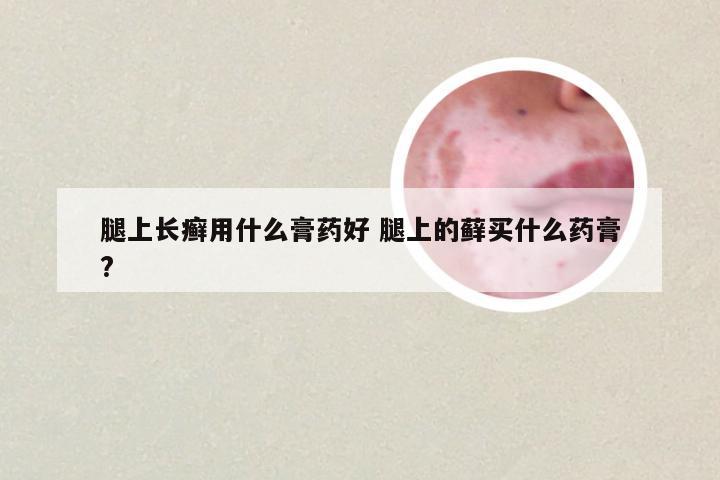 腿上长癣用什么膏药好 腿上的藓买什么药膏?
