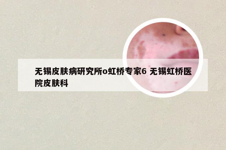 无锡皮肤病研究所o虹桥专家6 无锡虹桥医院皮肤科