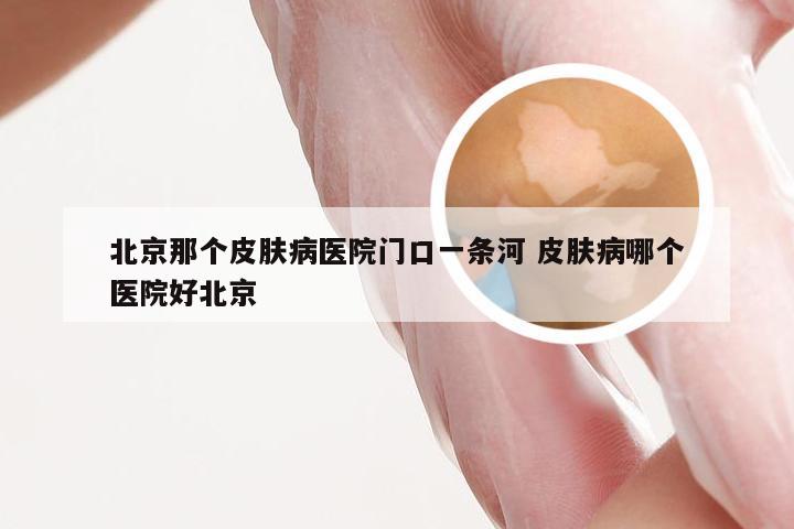 北京那个皮肤病医院门口一条河 皮肤病哪个医院好北京