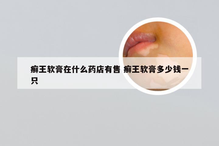 癣王软膏在什么药店有售 癣王软膏多少钱一只