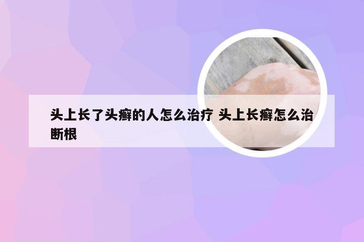 头上长了头癣的人怎么治疗 头上长癣怎么治断根