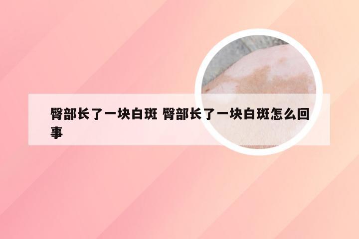 臀部长了一块白斑 臀部长了一块白斑怎么回事