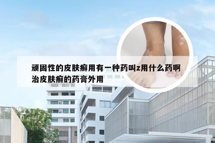 顽固性的皮肤癣用有一种药叫z用什么药啊 治皮肤癣的药膏外用