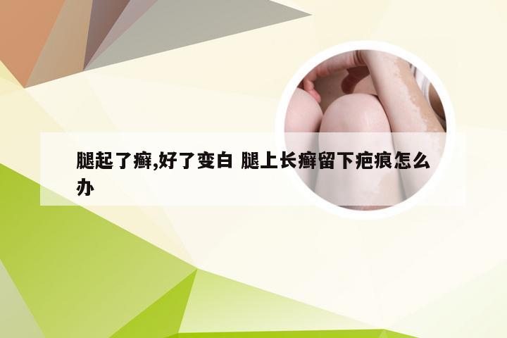 腿起了癣,好了变白 腿上长癣留下疤痕怎么办