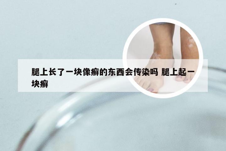 腿上长了一块像癣的东西会传染吗 腿上起一块癣