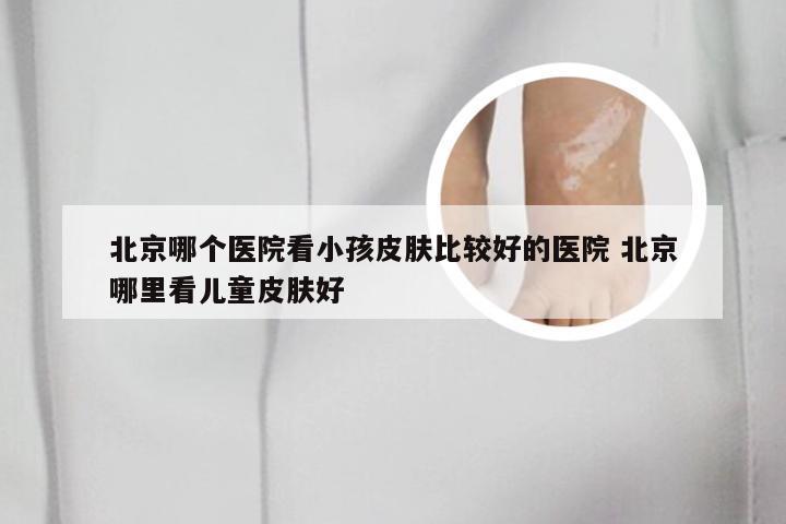 北京哪个医院看小孩皮肤比较好的医院 北京哪里看儿童皮肤好