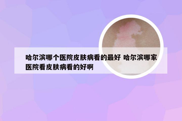 哈尔滨哪个医院皮肤病看的最好 哈尔滨哪家医院看皮肤病看的好啊