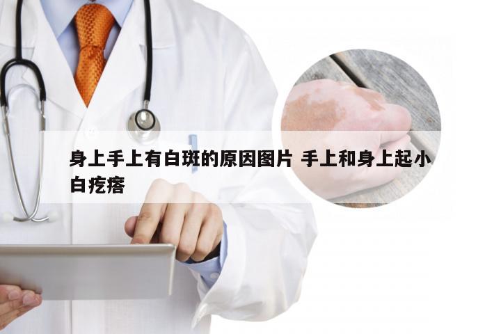 身上手上有白斑的原因图片 手上和身上起小白疙瘩