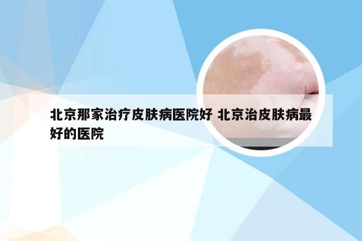 北京那家治疗皮肤病医院好 北京治皮肤病最好的医院