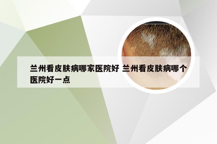 兰州看皮肤病哪家医院好 兰州看皮肤病哪个医院好一点